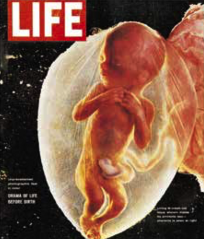 Première photo d'un fœtus humain publiée dans la presse (Couverture de Life, 1965, photo de Lennart Nilsson). Photo 12 / UIG via Getty Images